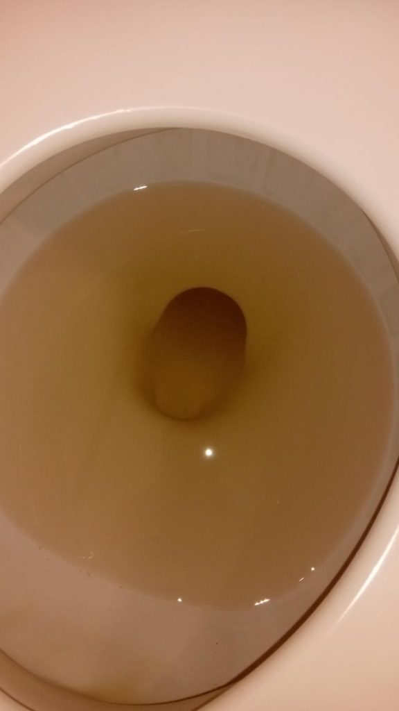 Why Is My Toilet Water Brown