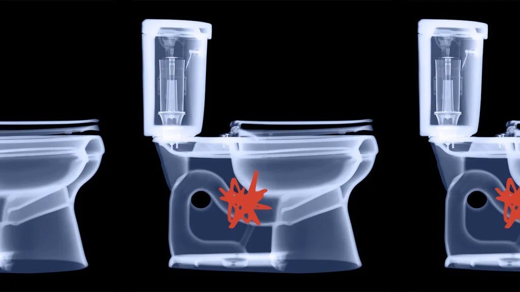 A modern white toilet in a bright bathroom setting representing common digestive health issues.